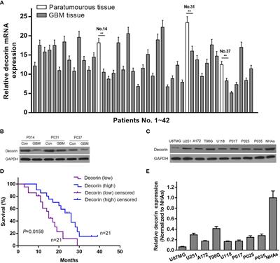 Decorin Suppresses Invasion and EMT Phenotype of Glioma by Inducing Autophagy via c-Met/Akt/mTOR Axis